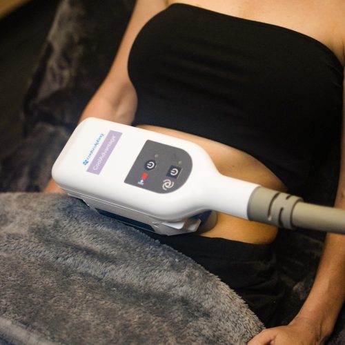 CoolSculpting